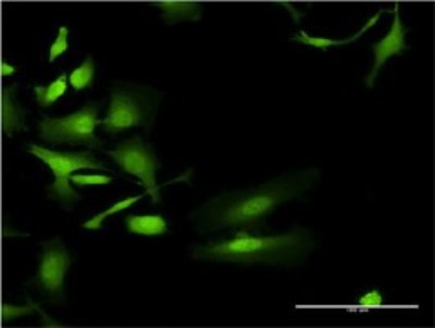 Immunocytochemistry/Immunofluorescence: UGT2B4 Antibody (2H6) [H00007363-M01] - Analysis of monoclonal antibody to UGT2B4 on HeLa cell. Antibody concentration 10 ug/ml.