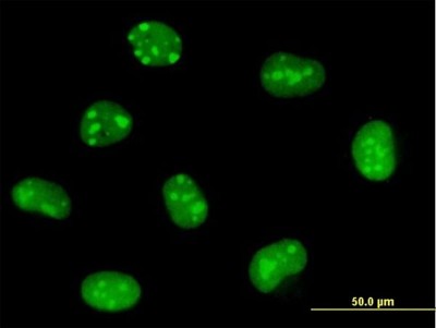 Immunocytochemistry/Immunofluorescence: EMG1 Antibody [H00010436-B01P] - Analysis of purified antibody to EMG1 on HeLa cell. (antibody concentration 10 ug/ml)