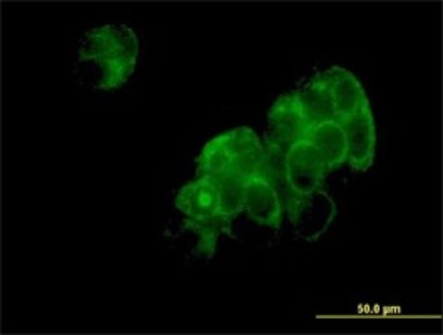 Immunocytochemistry/Immunofluorescence: Aspartyl Aminopeptidase Antibody (2F9-3A7) [H00023549-M01] - Analysis of monoclonal antibody to DNPEP on MCF-7 cell. Antibody concentration 10 ug/ml.