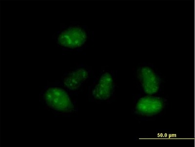 Immunocytochemistry/Immunofluorescence: ALS2CR15 Antibody [H00130026-B01P] - Analysis of purified antibody to ALS2CR15 on HeLa cell. (antibody concentration 10 ug/ml)