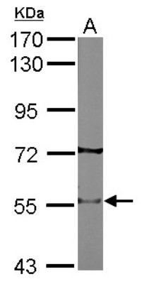 Western Blot: Nicotinic Acetylcholine Receptor beta 2 Antibody [NBP2-15040] - Sample (50 ug of whole cell lysate) A: Mouse brain 7. 5% SDS PAGE; antibody diluted at 1:5000.