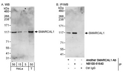Western Blot: SmarcAL1 Antibody [NB100-81640] - Detection of Human SMARCAL1 on HeLa whole cell lysate using NB100-81640.  SMARCAL1 was also immunoprecipitated by another rabbit anti-SMARCAL1 antibody.