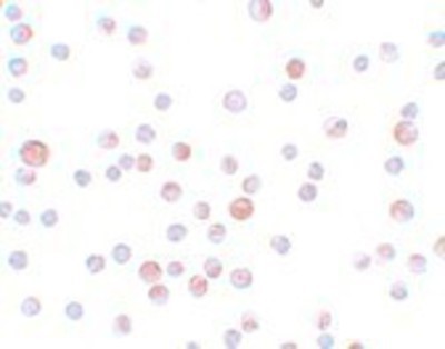 Immunocytochemistry/Immunofluorescence: CABP7 Antibody [NBP1-77191] - HeLa cells with CaBP7 antibody at 4 ug/mL.