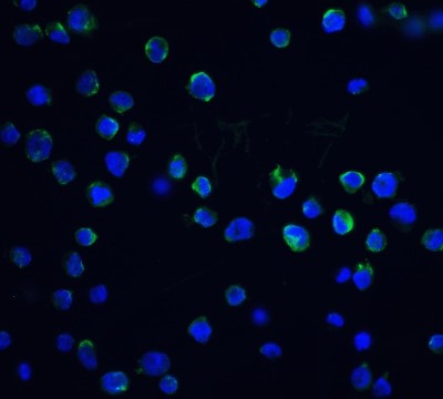 Immunocytochemistry/Immunofluorescence: DFF40/CAD Antibody [NBP1-76948] - Staining of DFF40 in K562 cells with DFF40 antibody at 20 ug/ml.