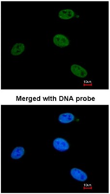Immunocytochemistry/Immunofluorescence: XPB Antibody [NBP1-31389] - Analysis of HeLa, using NBP1-31389 at 1:200 dilution.