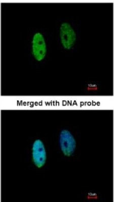 Immunocytochemistry/Immunofluorescence: DENND1B Antibody [NBP1-32715] - Paraformaldehyde-fixed HeLa, using antibody at 1:200 dilution.