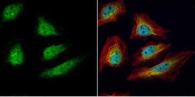 Immunocytochemistry/Immunofluorescence: UbcH3/Cdc34 Antibody [NBP1-32153] - HeLa cells were fixed in 4% paraformaldehyde at RT for 15 min. Green: CDC34 protein stained by CDC34 antibody [N1C3] diluted at 1:200. Red: alpha Tubulin, a cytoskeleton marker, stained by alpha Tubulin antibody [B-5-1-2] diluted at 1:10000. Blue: Hoechst 33342 staining.