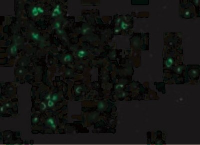 Immunocytochemistry/Immunofluorescence: IL-27 R alpha/WSX-1/TCCR Antibody [NBP1-76727] - Immunofluorescence of TCCR in Human Spleen cells with TCCR antibody at 20 ug/mL.