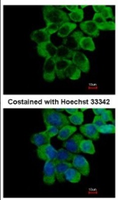 Immunocytochemistry/Immunofluorescence: RNF10 Antibody [NBP2-20174] - Immunofluorescence analysis of paraformaldehyde-fixed A431, using antibody at 1:500 dilution.