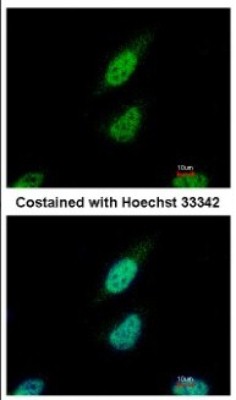 Immunocytochemistry/Immunofluorescence: NARF Antibody [NBP2-19475] - Immunofluorescence analysis of paraformaldehyde-fixed HeLa, using antibody at 1:500 dilution.