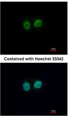 Immunocytochemistry/Immunofluorescence: RCC2 Antibody [NBP2-20118] - Analysis of paraformaldehyde-fixed MCF-7, using antibody at 1:500 dilution.