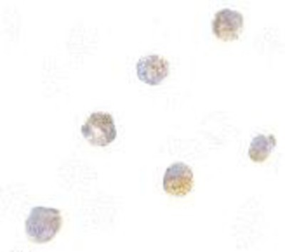 Immunocytochemistry/Immunofluorescence: ASC/TMS1 Antibody [NBP1-77297] - HL60 cells with ASC/TMS1 antibody at 5 ug/ml.