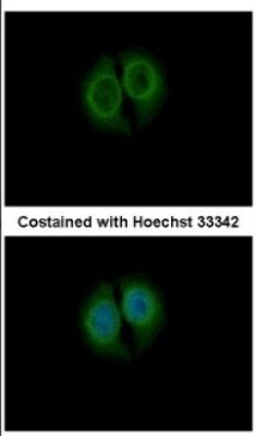 Immunocytochemistry/Immunofluorescence: CPNE4 Antibody [NBP2-15987] - Immunofluorescence analysis of methanol-fixed MCF-7, using antibody at 1:200 dilution.