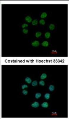 Immunocytochemistry/Immunofluorescence: RTKN Antibody [NBP2-20239] - Analysis of paraformaldehyde-fixed A431, using antibody at 1:200 dilution.
