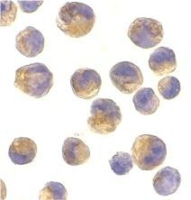 Immunocytochemistry/Immunofluorescence: DOK1 Antibody [NBP1-77064] - K562 cells with DOK1 antibody at 2 ug/ml.