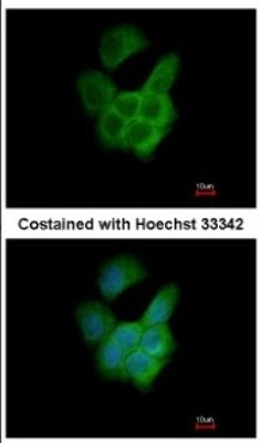 Immunocytochemistry/Immunofluorescence: FLJ21908 Antibody [NBP2-16506] - Immunofluorescence analysis of paraformaldehyde-fixed A431, using antibody at 1:200 dilution.