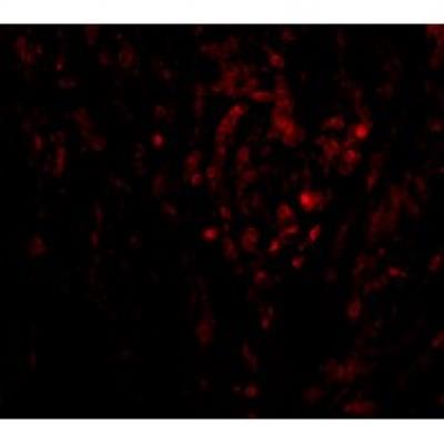 Immunocytochemistry/Immunofluorescence: TRAF3IP2 Antibody [NBP1-76712] - Immunofluorescence of CIKS in human lung tissue with CIKS antibody at 20 ug/mL.