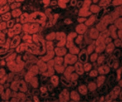 Immunocytochemistry/Immunofluorescence: ACE-2 Antibody [NBP1-76612] - Immunofluorescence of ACE2 in Human Kidney tissue with ACE2 antibody at 10 ug/mL.