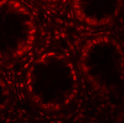 Immunocytochemistry/Immunofluorescence: LRRFIP1 Antibody [NBP1-76545] - Immunofluorescence of LRRFIP1 in human colon tissue with LRRFIP1 antibody at 20 ug/mL.