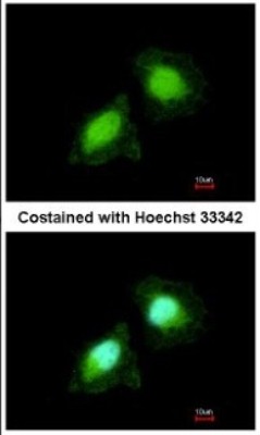 Immunocytochemistry/Immunofluorescence: AIMP2 Antibody [NBP2-15315] - Paraformaldehyde-fixed HeLa, using antibody at 1:200 dilution.
