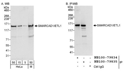 Western Blot: SMARCAD1 Antibody [NB100-79835] - Detection of Human and Mouse SMARCAD1/ETL1 on HeLa whole cell lysate using NB100-79835. SMARCAD1/ETL1 was also IPed by rabbit anti-  SMARCAD1/ETL1 antibody NB100-79834.