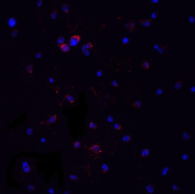 Immunofluorescence: MyD88 Antibody [NBP1-76465] - Analysis of MyD88 in Jurkat cells with MyD88 antibody at 20 ug/ml.