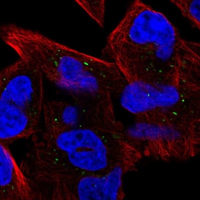 Immunocytochemistry/Immunofluorescence: UBE2CBP Antibody [NBP1-86757] - Staining of human cell line RH-30 shows localization to rods & rings.