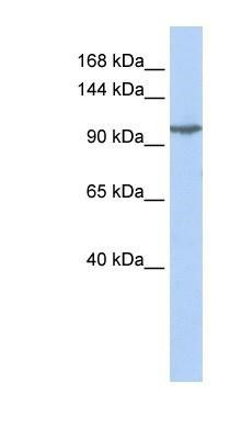 Western Blot: KA2/GRIK5/Glutamate Receptor KA2 Antibody [NBP1-80270] - Jurkat cell lysate, Antibody Titration: 0.2-1 ug/ml