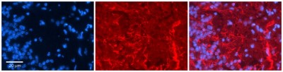 Immunocytochemistry/Immunofluorescence: KA2/GRIK5/Glutamate Receptor KA2 Antibody [NBP1-80270] - Antibody  Formalin Fixed Paraffin Embedded Tissue: Human Pineal Tissue  Observed Staining: Membrane in cell processes