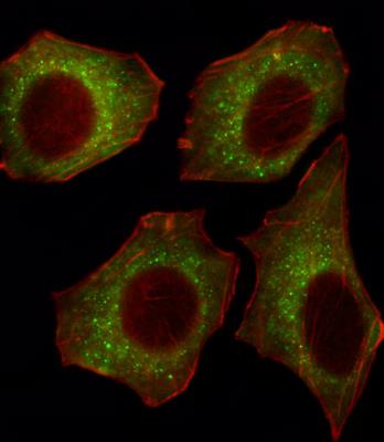 Immunocytochemistry/Immunofluorescence: CACNA2D2 Antibody [NBP2-30044] - Fluorescent image of U251 cell stained with CACNA2D2 Antibody (Center)(NBP2-30044).U251 cells were fixed with 4% PFA (20 min), permeabilized with Triton X-100 (0.1%, 10 min), then incubated with CACNA2D2 primary antibody (1:25, 1 h at 37). For secondary antibody, Alexa Fluor 488 conjugated donkey anti-rabbit antibody (green) was used (1:400, 50 min at 37).Cytoplasmic actin was counterstained with Alexa Fluor 555 (red) conjugated Phalloidin (7units/ml, 1 h at 37).CACNA2D2 immunoreactivity is localized to Cytoplasm significantly.