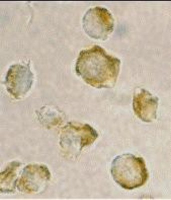 Immunocytochemistry/Immunofluorescence: Nudel Antibody [NBP1-76677] - Jurkat cells with Nudel antibody at 2 ug/ml.