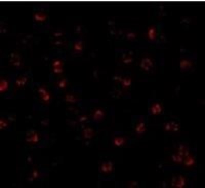 Immunocytochemistry/Immunofluorescence: ATG7 Antibody [NBP1-76649] - MCF7 cells.Dilution 20 ug/mL.