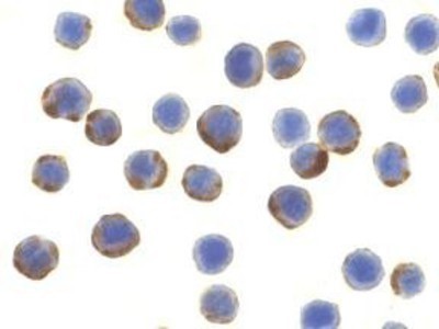 Immunocytochemistry/Immunofluorescence: ATG7 Antibody [NBP1-76649] - MCF7 cells with APG7 antibody at 10 ug/ml.