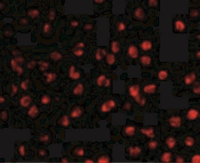 Immunofluorescence: AICDA Antibody [NBP1-77235] - Ramos cells with AICDA antibody at 20 ug/mL.