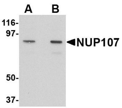 Western Blot: Nucleoporin 107 Antibody [NBP1-76927] - A549 cell lysate with NUP107 antibody at (A) 1 and (B) 2 ug/mL.