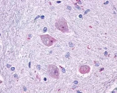 Immunohistochemistry-Paraffin: Muscarinic Acetylcholine Receptor M4/CHRM4 Antibody [NLS220] - Analysis of anti-CHRM4 / M4 antibody with human brain, neurons and glia.