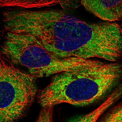 Immunocytochemistry/Immunofluorescence: LARP4 Antibody [NBP1-80890] - Immunofluorescent staining of human cell line A-431 shows localization to cytosol.