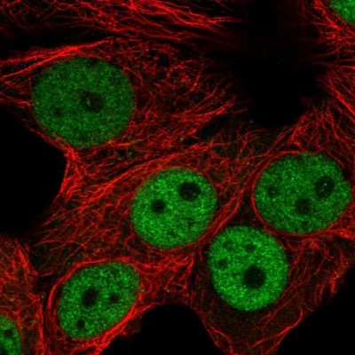 Immunocytochemistry/Immunofluorescence: RNF168 Antibody [NBP2-54959] - Staining of human cell line MCF7 shows localization to nucleoplasm.