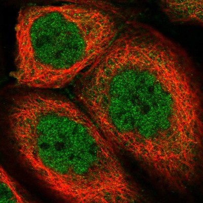 Immunocytochemistry/Immunofluorescence: CCDC113 Antibody [NBP2-14444] - Immunofluorescent staining of human cell line A-431 shows localization to nucleoplasm & cytosol.