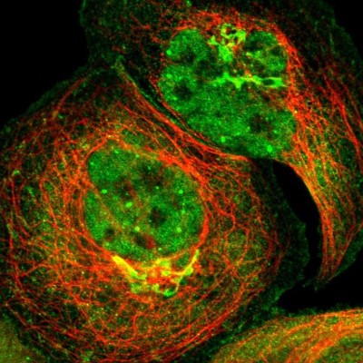 Immunocytochemistry/Immunofluorescence: ZNF18 Antibody [NBP1-81758] - Immunofluorescent staining of human cell line A-431 shows localization to nucleoplasm, plasma membrane, cytosol & the Golgi apparatus.