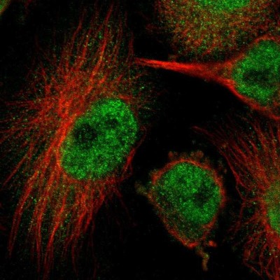 Immunocytochemistry/Immunofluorescence: HUWE1 Antibody [NBP1-83127] - Staining of human cell line U-251 MG shows localization to nucleoplasm & cytosol.