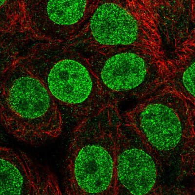 Immunocytochemistry/Immunofluorescence: TETRAN Antibody [NBP2-47607] - Immunofluorescent staining of human cell line MCF7 shows localization to nucleoplasm & nuclear membrane.