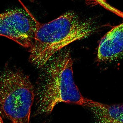 Immunocytochemistry/Immunofluorescence: GIGYF1 Antibody [NBP1-81784] - Immunofluorescent staining of human cell line U-251 MG shows localization to vesicles.
