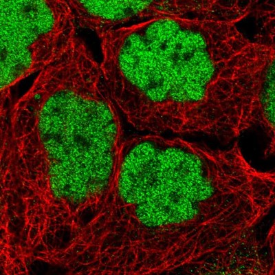Immunocytochemistry/Immunofluorescence: MIER1 Antibody [NBP1-81730] - Immunofluorescent staining of human cell line A-431 shows localization to nucleoplasm.