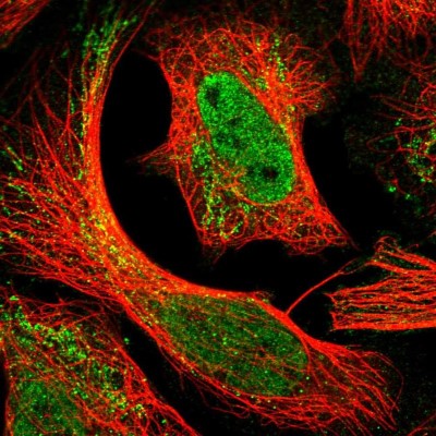Immunocytochemistry/Immunofluorescence: TTC9B Antibody [NBP1-82042] - Staining of human cell line U-2 OS shows positivity in nucleus but not nucleoli and mitochondria.