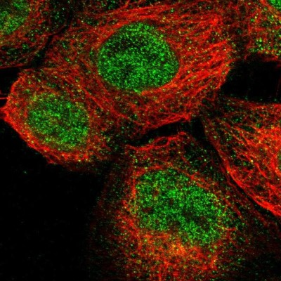 Immunocytochemistry/Immunofluorescence: ENTPD8 Antibody [NBP1-82517] - Immunofluorescent staining of human cell line A-431 shows localization to nucleoplasm & cytosol.