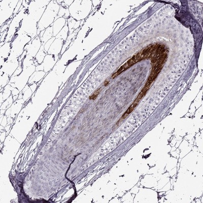 Immunocytochemistry/Immunofluorescence: Basalin Antibody [NBP1-80806] - Staining of hair shows strong cytoplasmic positivity in cells in internal root sheath.