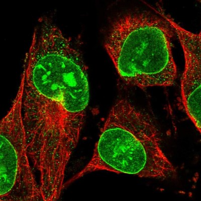 Immunocytochemistry/Immunofluorescence: Basalin Antibody [NBP1-80806] - Immunofluorescent staining of human cell line U-251 MG shows localization to nucleoli & nuclear membrane.