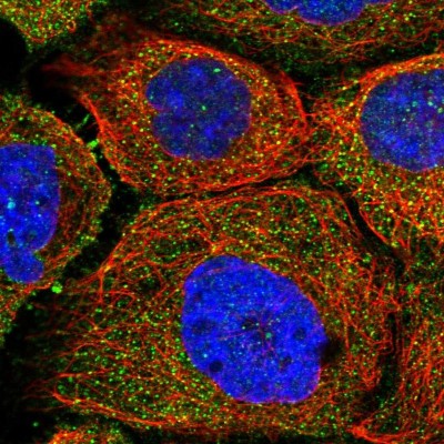 Immunocytochemistry/Immunofluorescence: HIPK4 Antibody [NBP1-81987] - Staining of human cell line A-431 shows positivity in cytoplasm.
