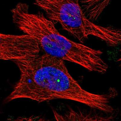 Immunocytochemistry/Immunofluorescence: DCAF10 Antibody [NBP1-82090] - Staining of human cell line U-251MG shows positivity in nucleoli.